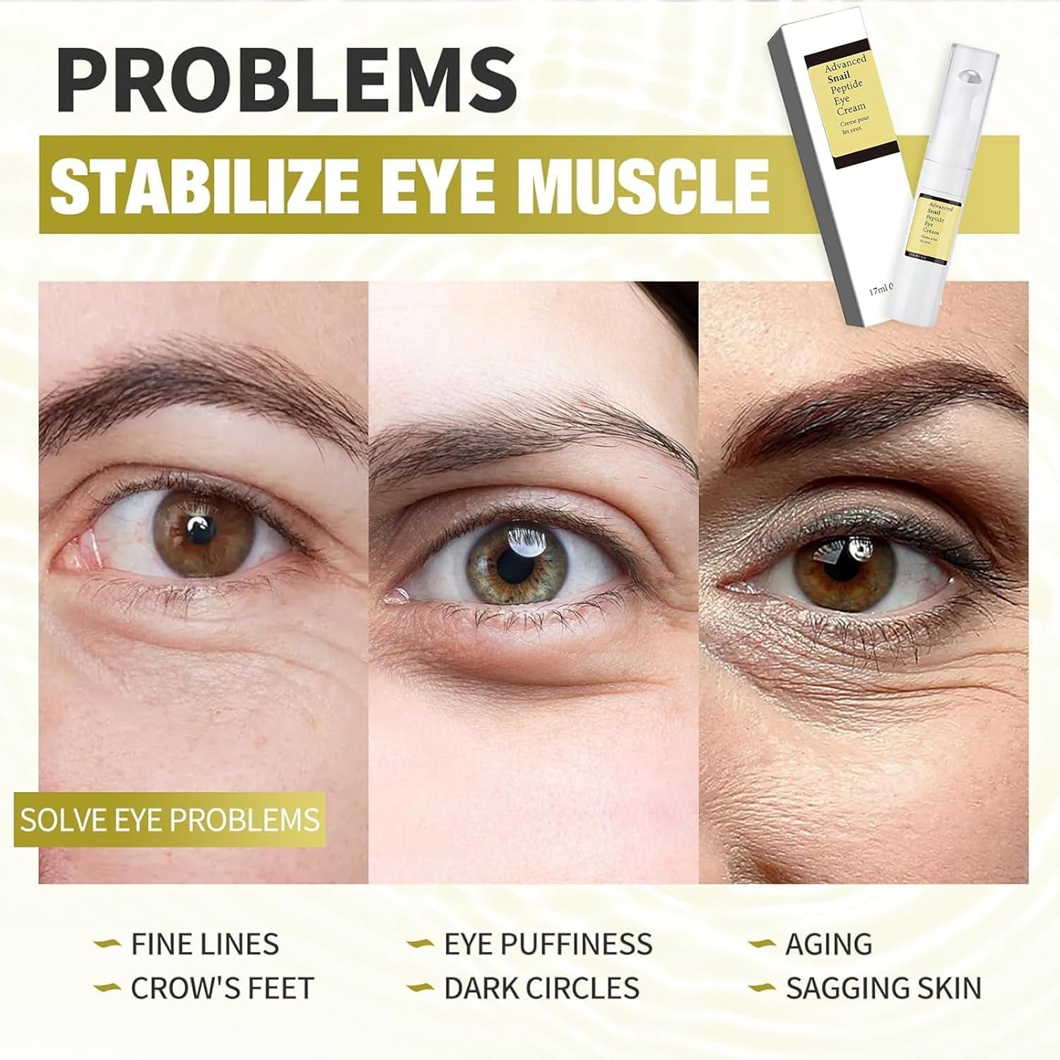 Snail Mucin, Roll-On Contorno Ojos, anti Ojeras Y Bolsas Mujer, Snail Mucin Eye Cream, Hidratante Antiojeras, Suaviza Las Arrugas De Los Ojos Y Reduce Las Ojeras, 17 Ml (A, A)