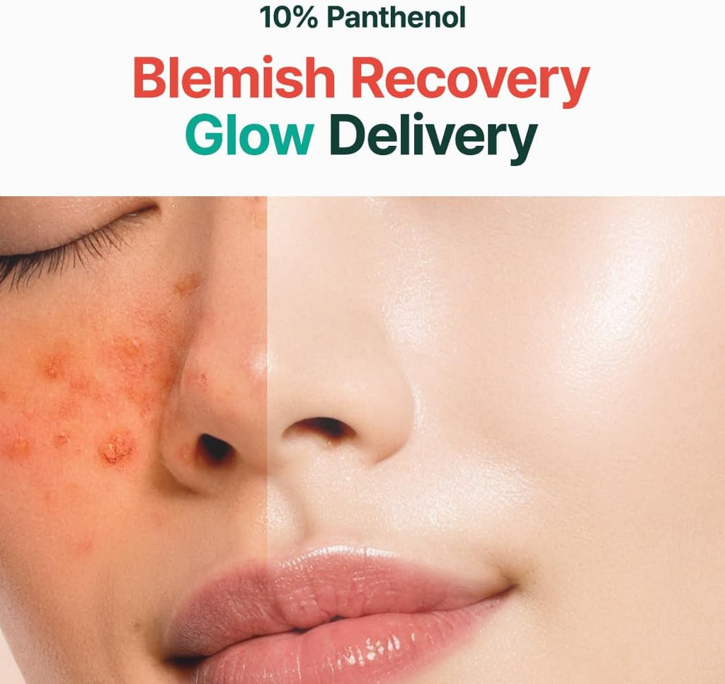 Post-Acne Moisturizer, Recovery & Glow Boost, Silicone-Free, Non-Comedogenic, Vegan, Korean Skincare, Mighty Bamboo Panthenol Cream, 3.38 Fl Oz / 100Ml