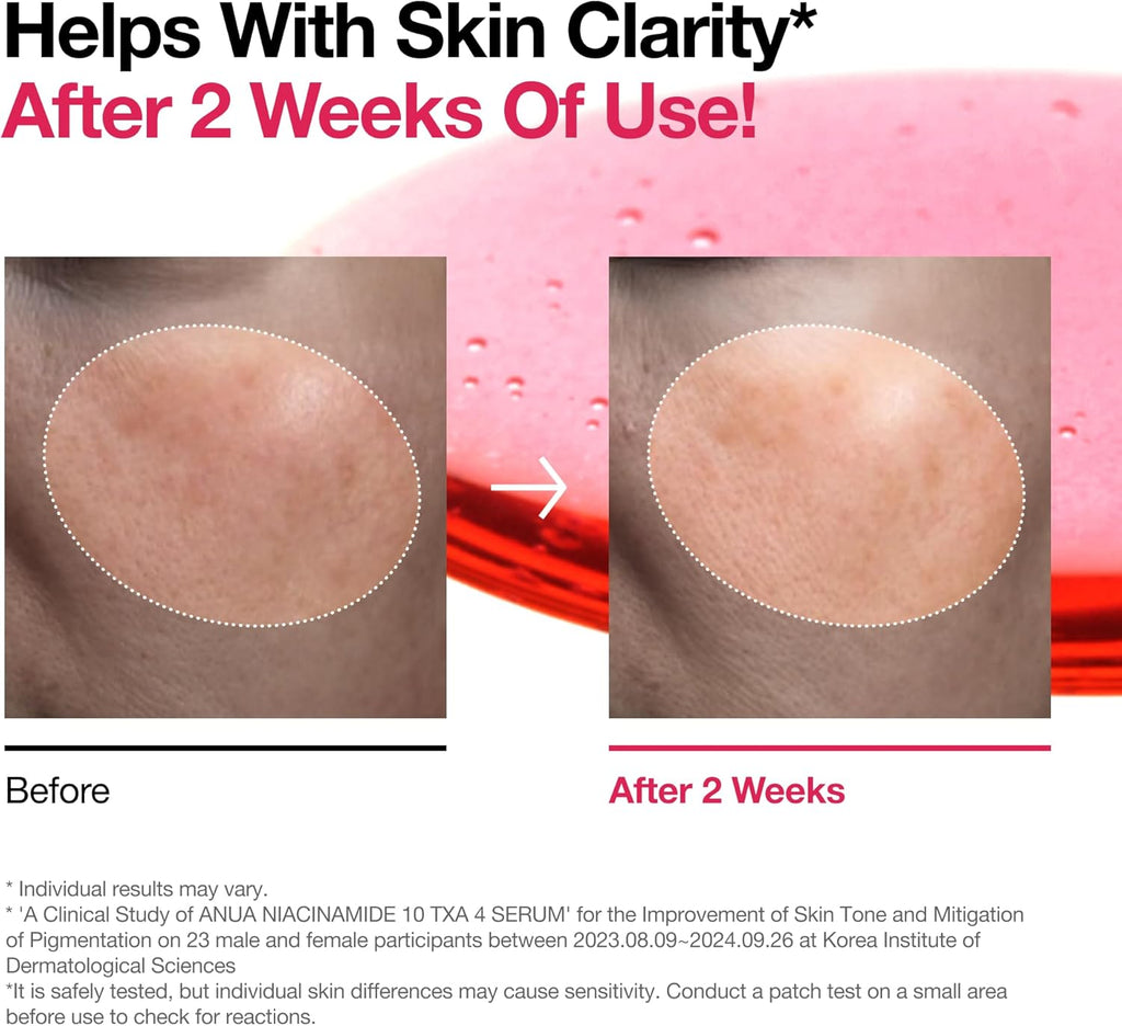 ANUA Suero Con 10% De Niacinamida Y 4% De Ácido Tranexámico, Ceramida, Ácido Hialurónico, Vitamina B12, Color Natural, Para Pieles Sensibles, Piel De Cristal Coreana, Sin Fragancia 30 Ml/1,01 Fl.Oz.