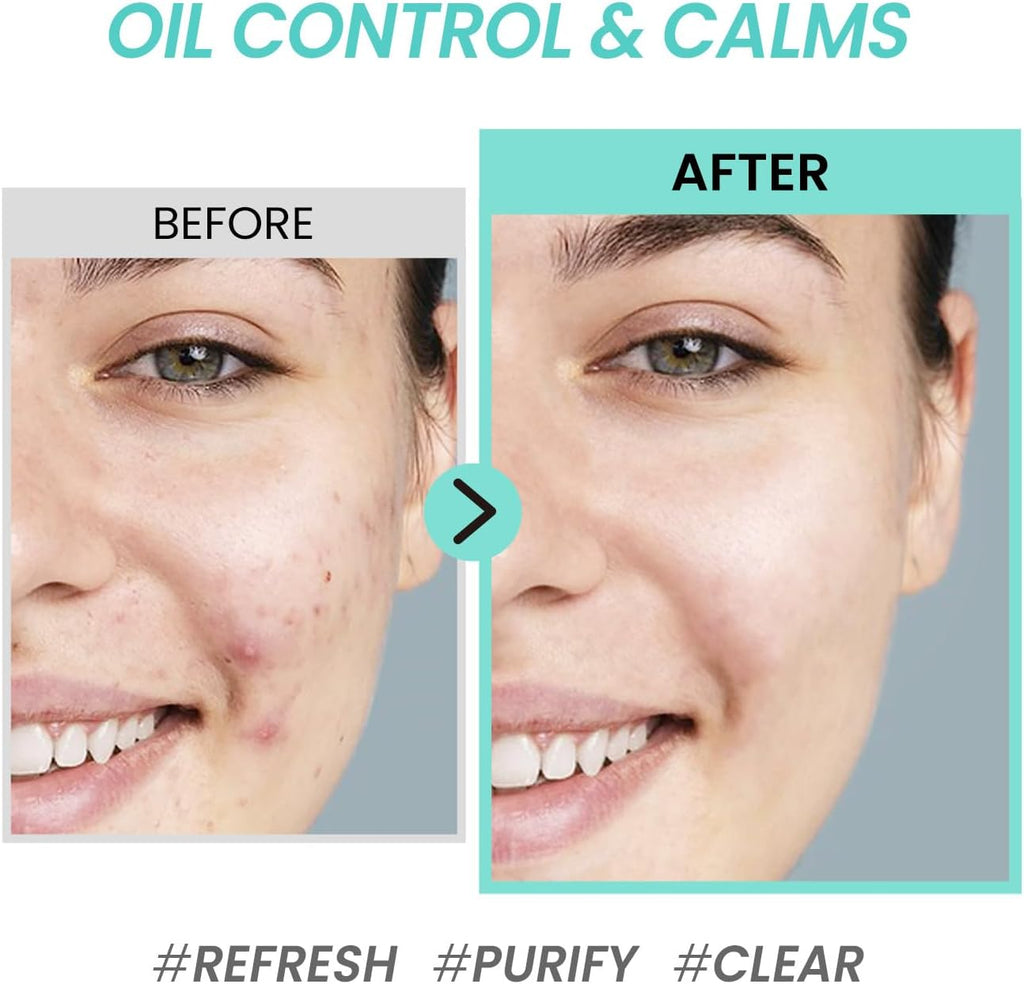 Coxir Tea Tree Pore&Sebum Emulsion, Emulsión 1 Unidad 100 Ml