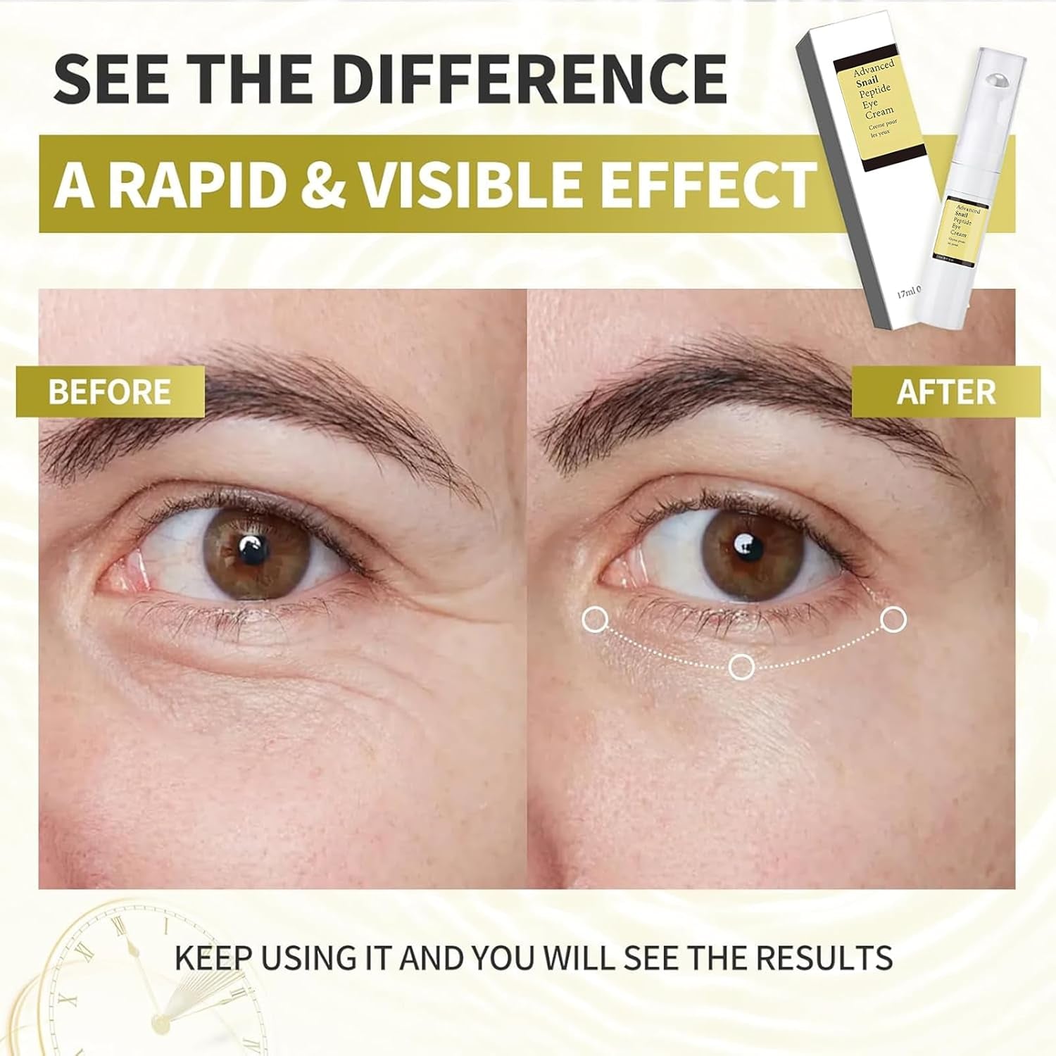 Snail Mucin, Roll-On Contorno Ojos, anti Ojeras Y Bolsas Mujer, Snail Mucin Eye Cream, Hidratante Antiojeras, Suaviza Las Arrugas De Los Ojos Y Reduce Las Ojeras, 17 Ml (A, A)